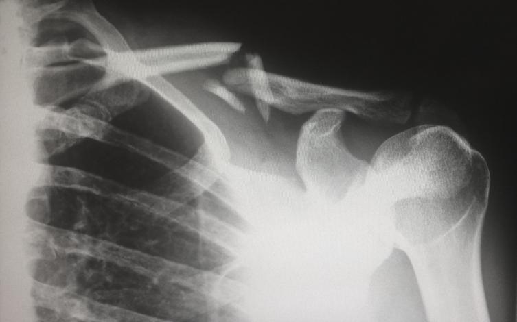Human X-Ray
